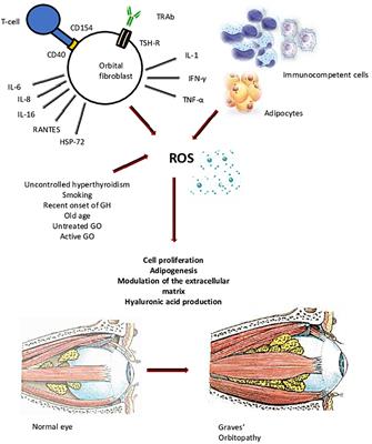 Frontiers | Antioxidant Therapy In Graves’ Orbitopathy